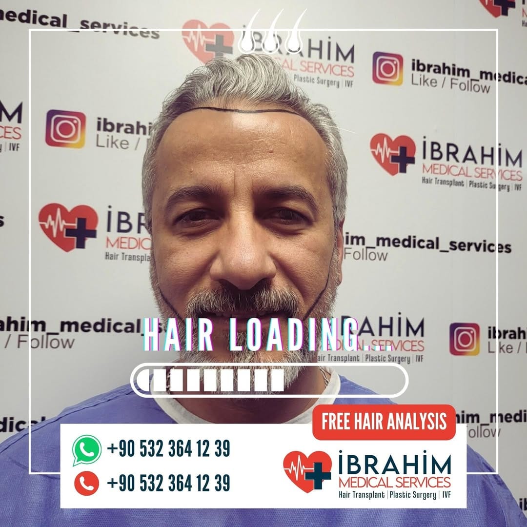 Post 8 by İbrahim Ayyıldız on Instagram (image)