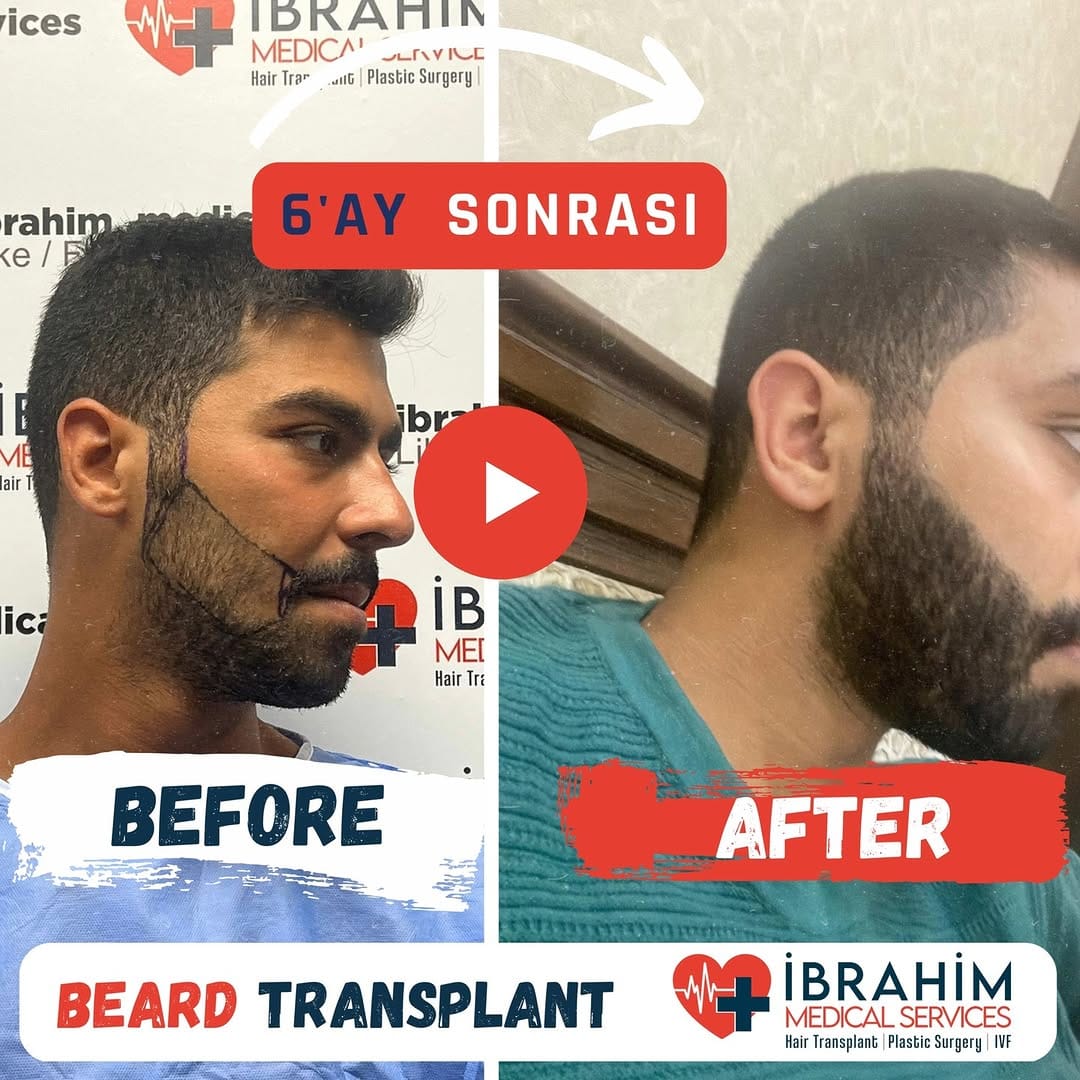 Post 2 by İbrahim Ayyıldız on Instagram (video)
