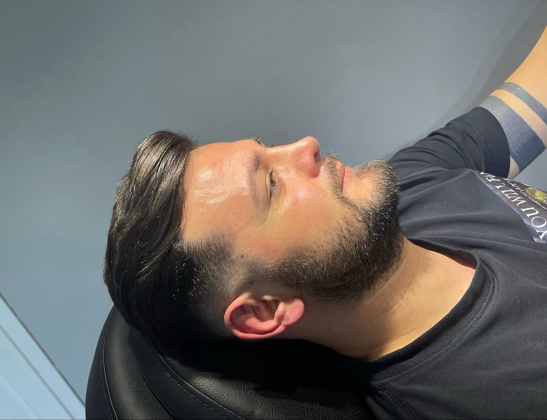 Post 1 by Dr. Hakan KARA- Rhinoplasty on Instagram (carousel)