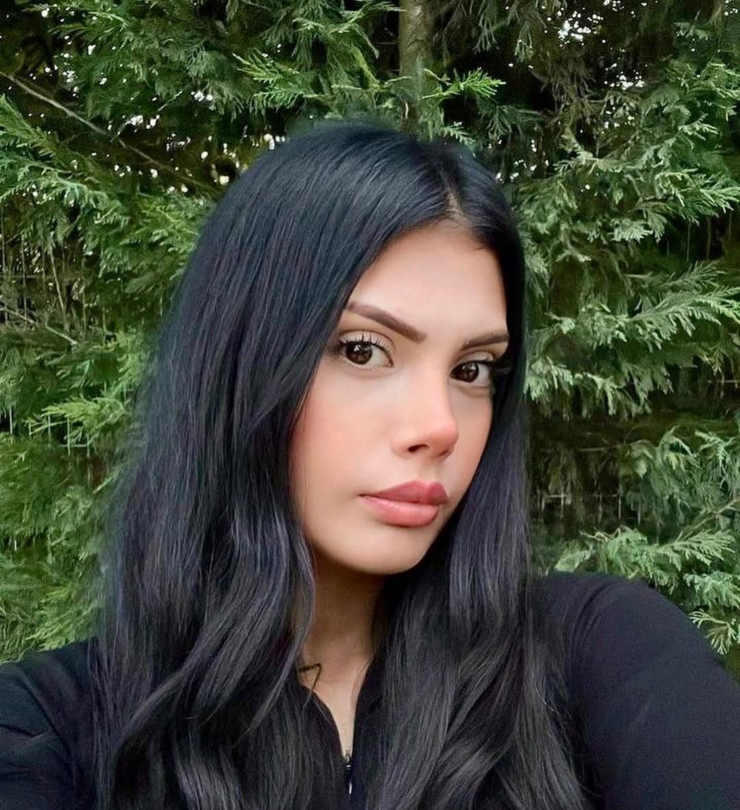Post 7 by Dr. Hakan KARA- Rhinoplasty on Instagram (carousel)
