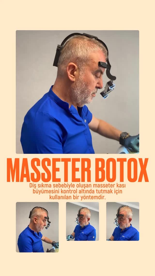 Post 9 by Op.Dr. Orhan Alan, MD on Instagram (video)