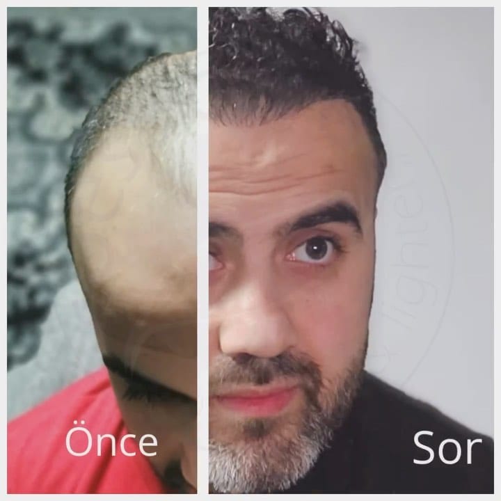 Post 5 by SOest Care on Instagram (video)