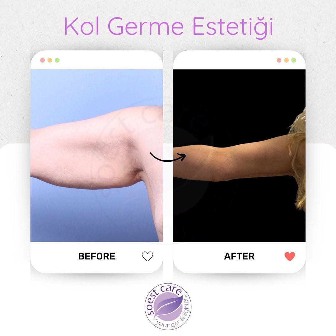 Post 7 by SOest Care on Instagram (carousel)