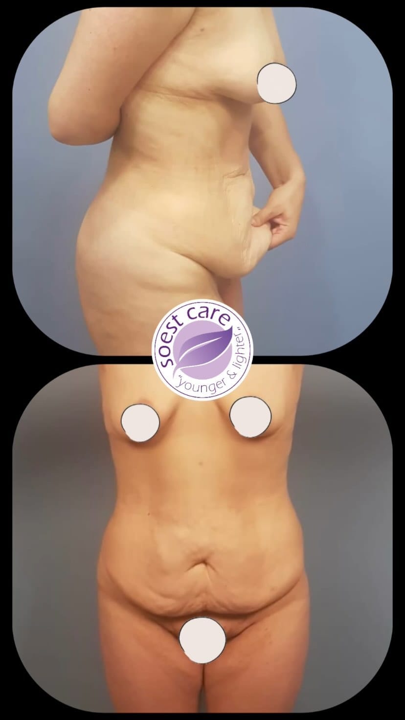 Post 9 by SOest Care on Instagram (video)