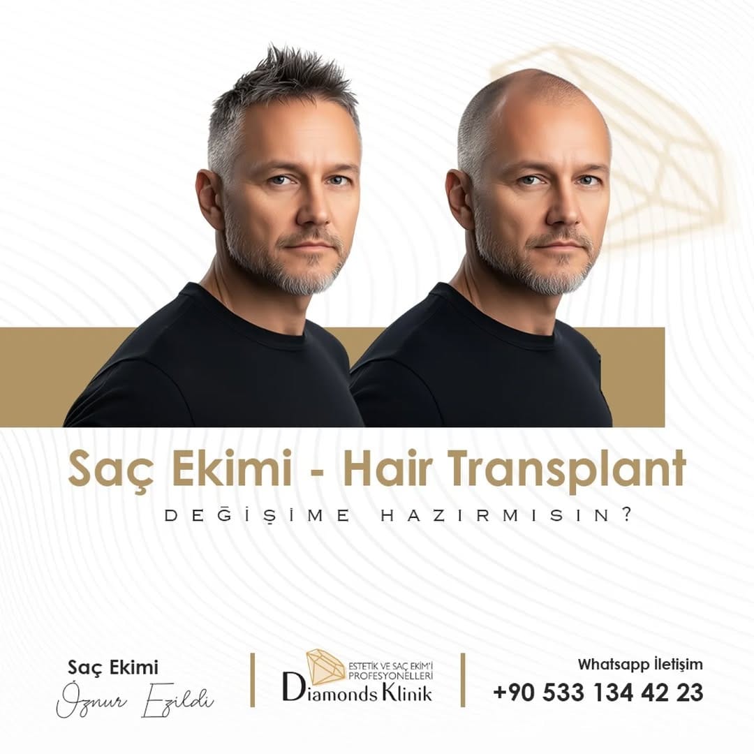 Post 7 by Diamonds Klinik on Instagram (image)