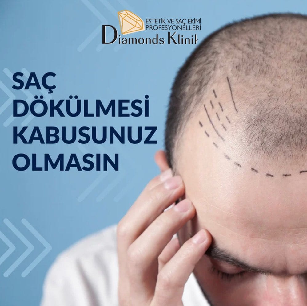 Post 8 by Diamonds Klinik on Instagram (image)