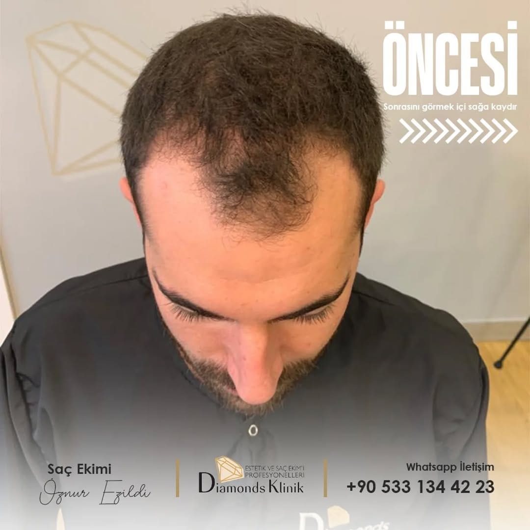 Post 5 by Diamonds Klinik on Instagram (carousel)