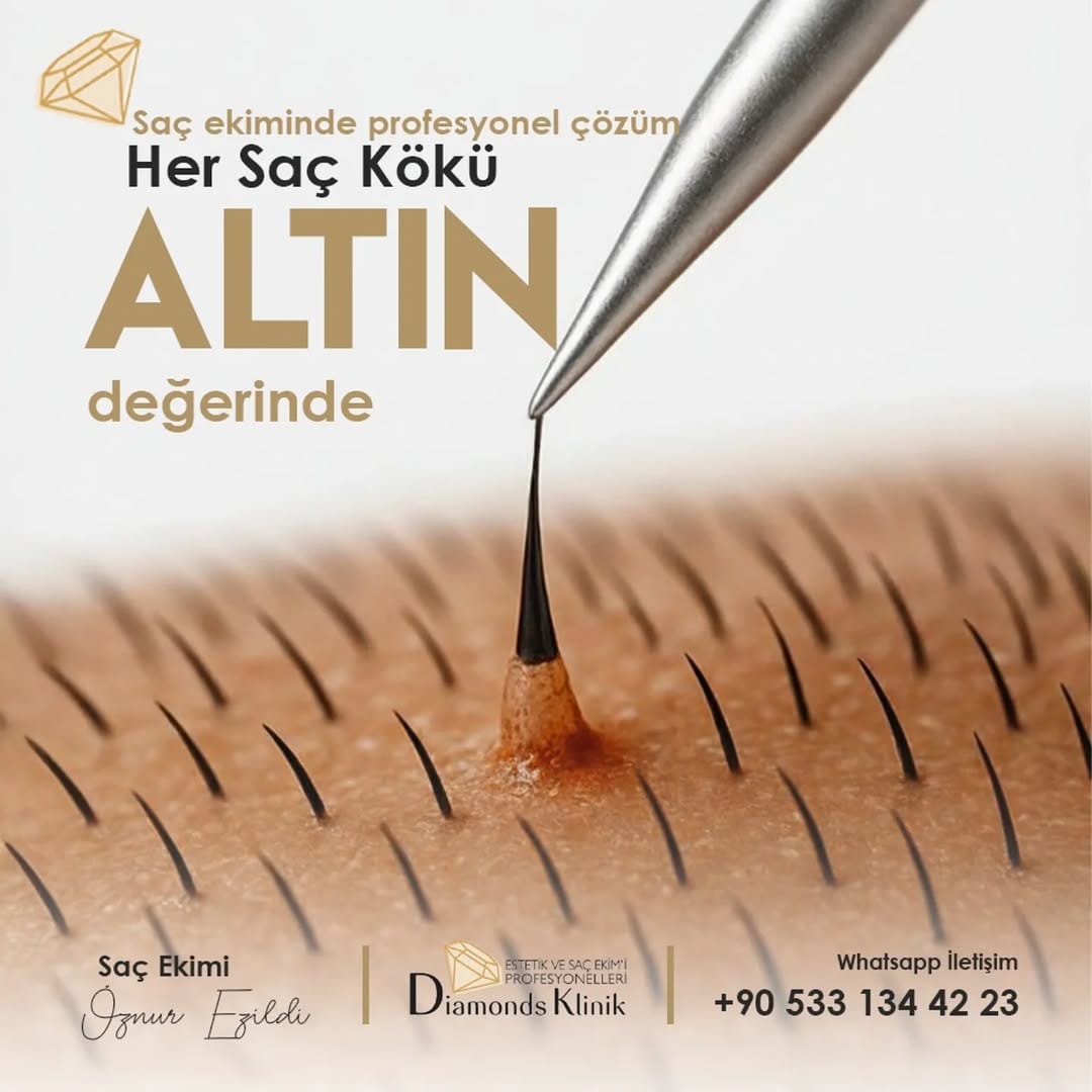 Post 2 by Diamonds Klinik on Instagram (image)