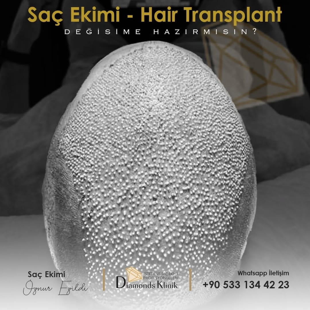 Post 6 by Diamonds Klinik on Instagram (image)