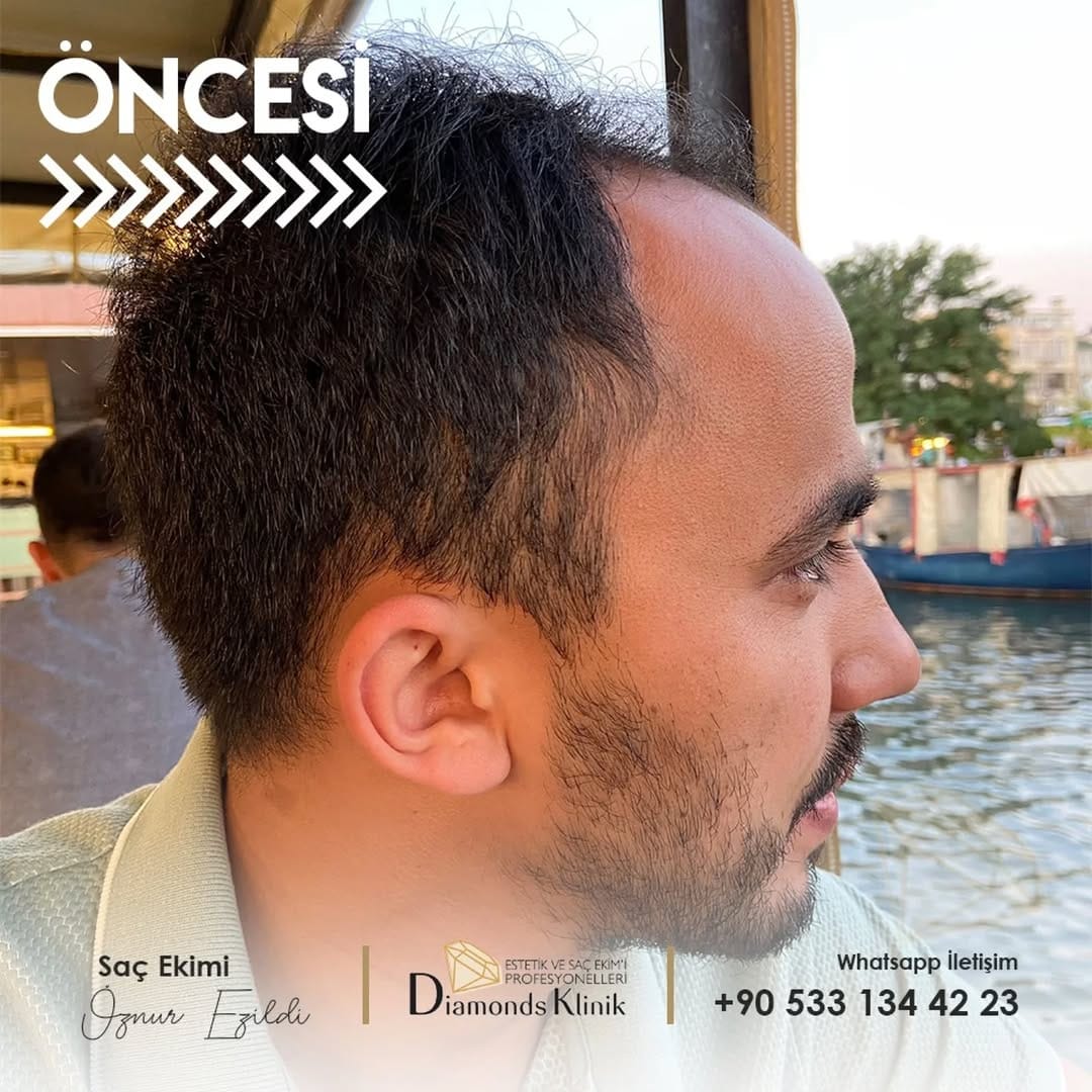 Post 3 by Diamonds Klinik on Instagram (carousel)