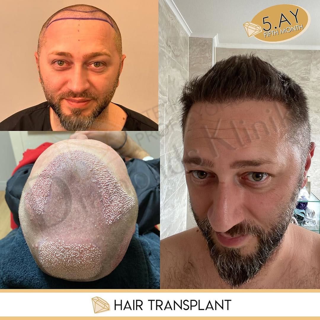 Post 10 by Diamonds Klinik on Instagram (image)