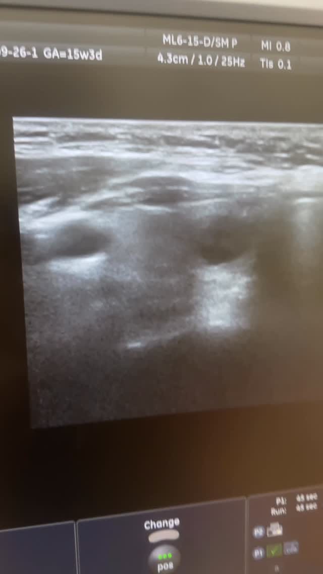 Post 8 by @usm_dr_aynure_memmedova on Instagram (video)