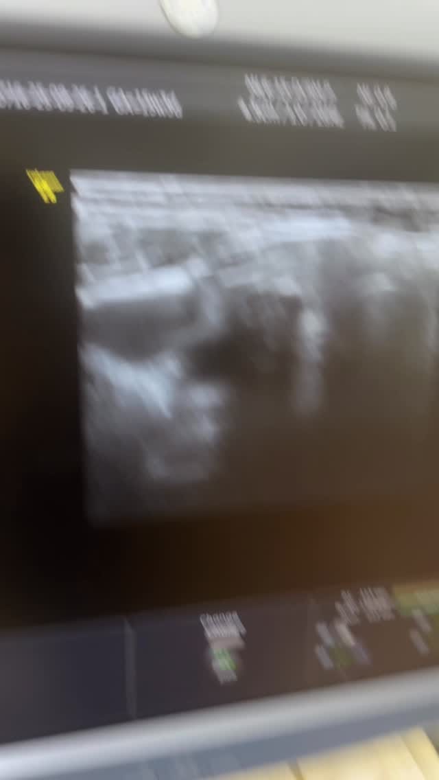 Post 7 by @usm_dr_aynure_memmedova on Instagram (video)