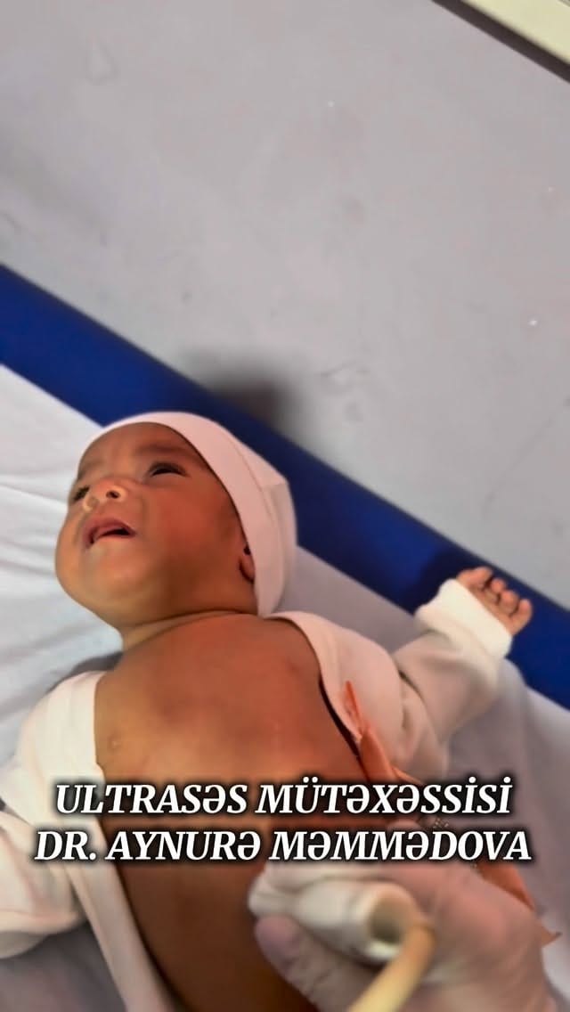 Post 5 by @usm_dr_aynure_memmedova on Instagram (video)
