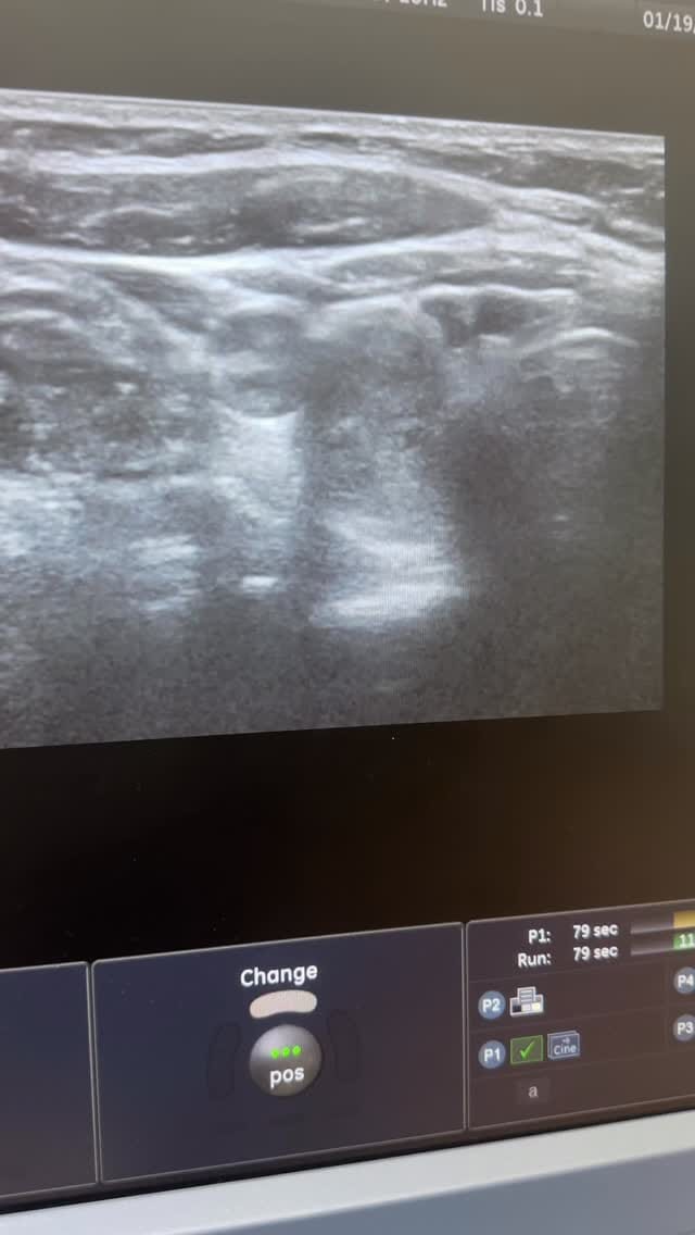 Post 2 by @usm_dr_aynure_memmedova on Instagram (video)