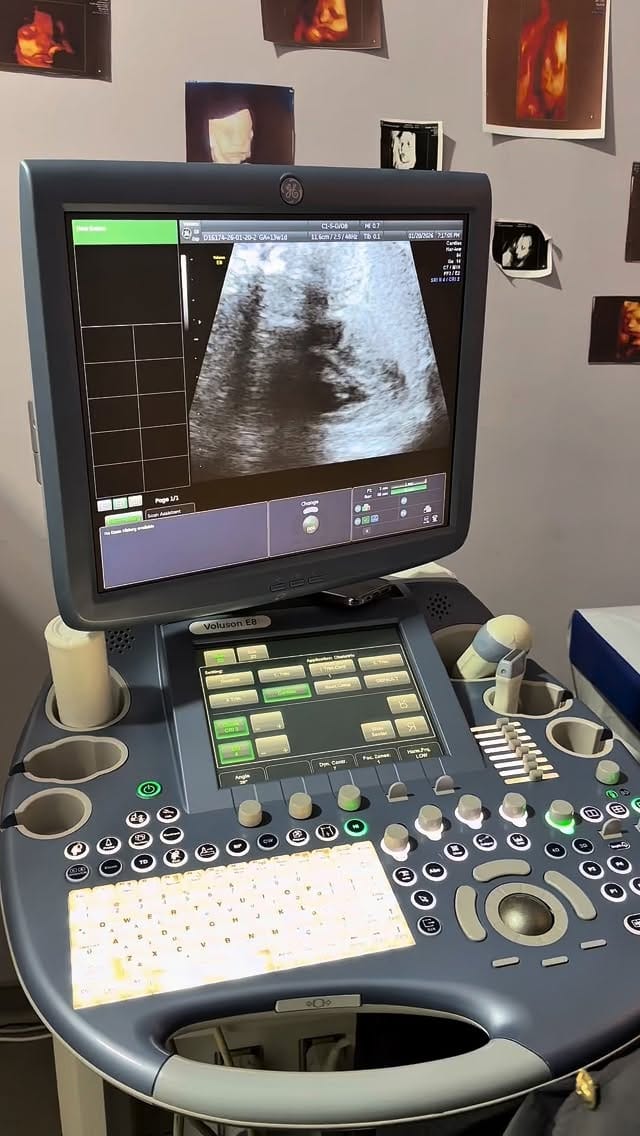 Post 1 by @usm_dr_aynure_memmedova on Instagram (video)