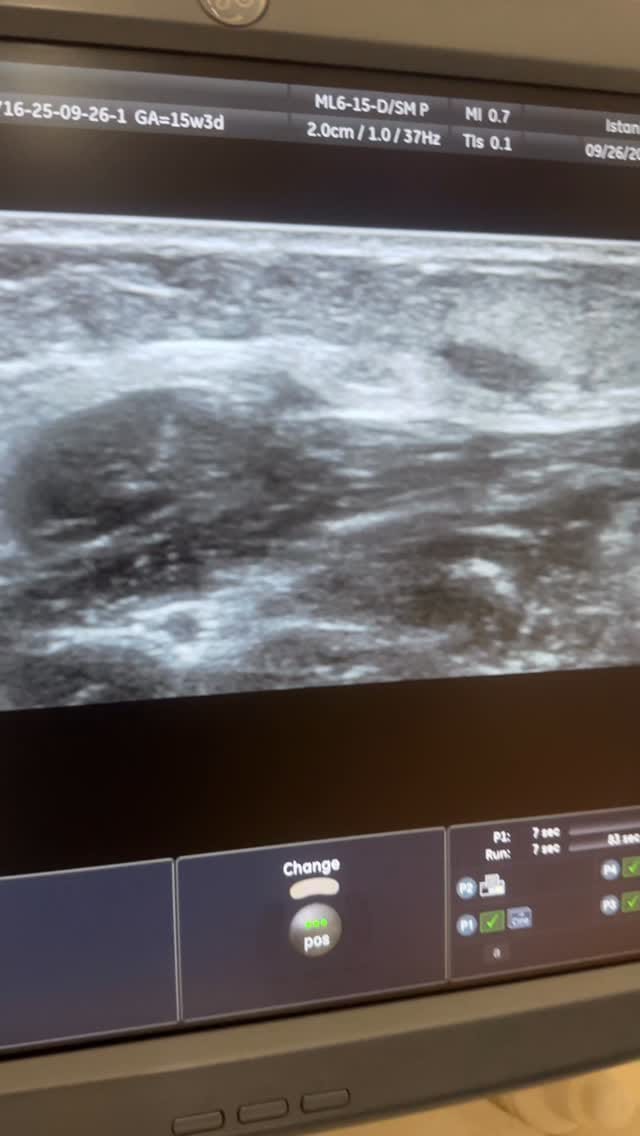 Post 6 by @usm_dr_aynure_memmedova on Instagram (video)