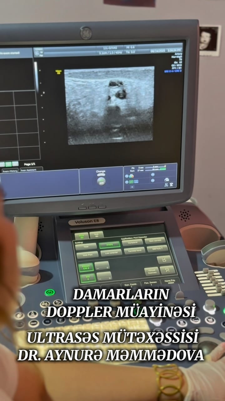 Post 9 by @usm_dr_aynure_memmedova on Instagram (video)