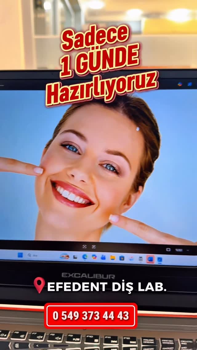 Post 4 by Dişlere fısıldayan adam on Instagram (video)