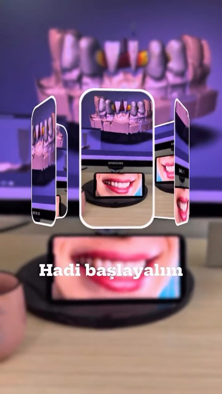 Post 5 by Dişlere fısıldayan adam on Instagram (video)