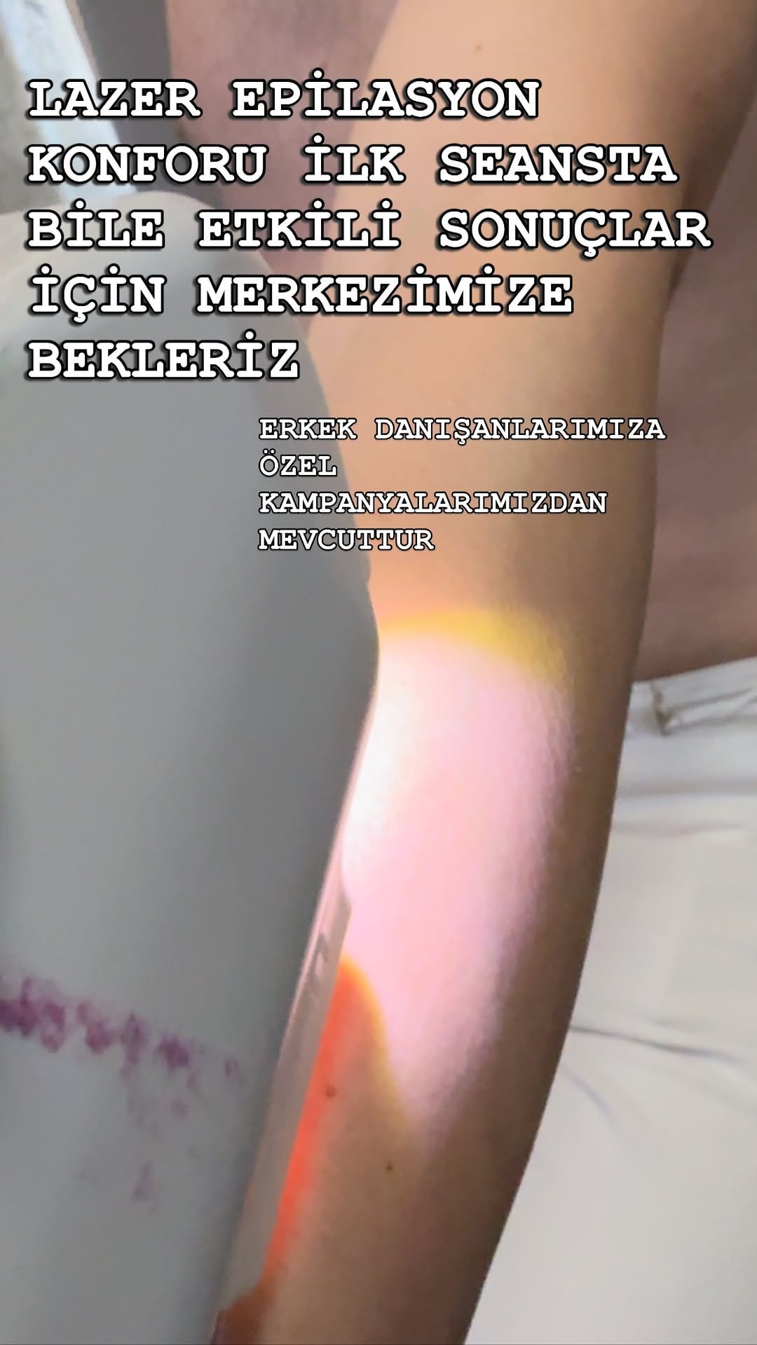 Post 8 by 𝗩İ𝗣 𝗛İ𝗭𝗠𝗘𝗧⚜️𝗟𝗔𝗭𝗘𝗥 𝗘𝗣İ𝗟𝗔𝗦𝗬𝗢𝗡 𝗠𝗘𝗥𝗞𝗘𝗭İ🪽PROTEZ TIRNAK&NAİL on Instagram (video)