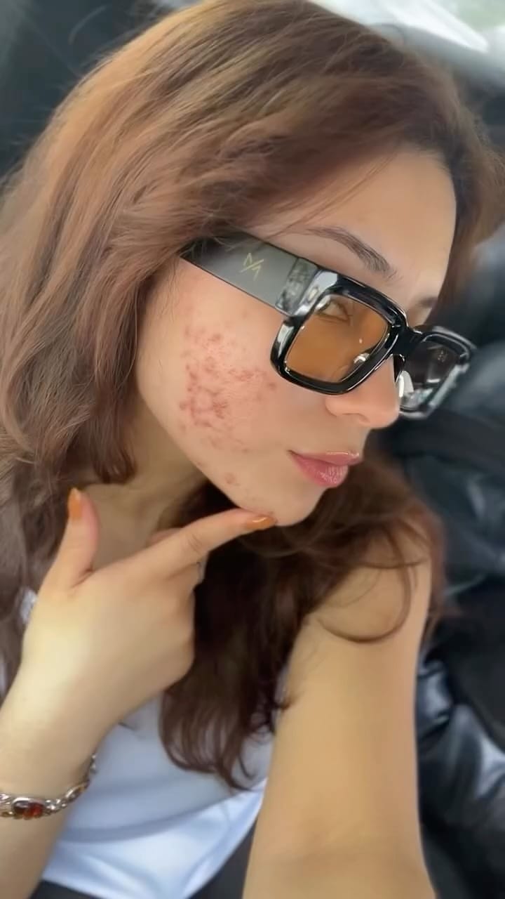 Post 10 by Perfecta | Cosmetología Facial on Instagram (video)