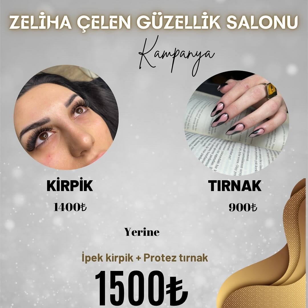 Post 10 by Protez Tırnak Ankara on Instagram (image)