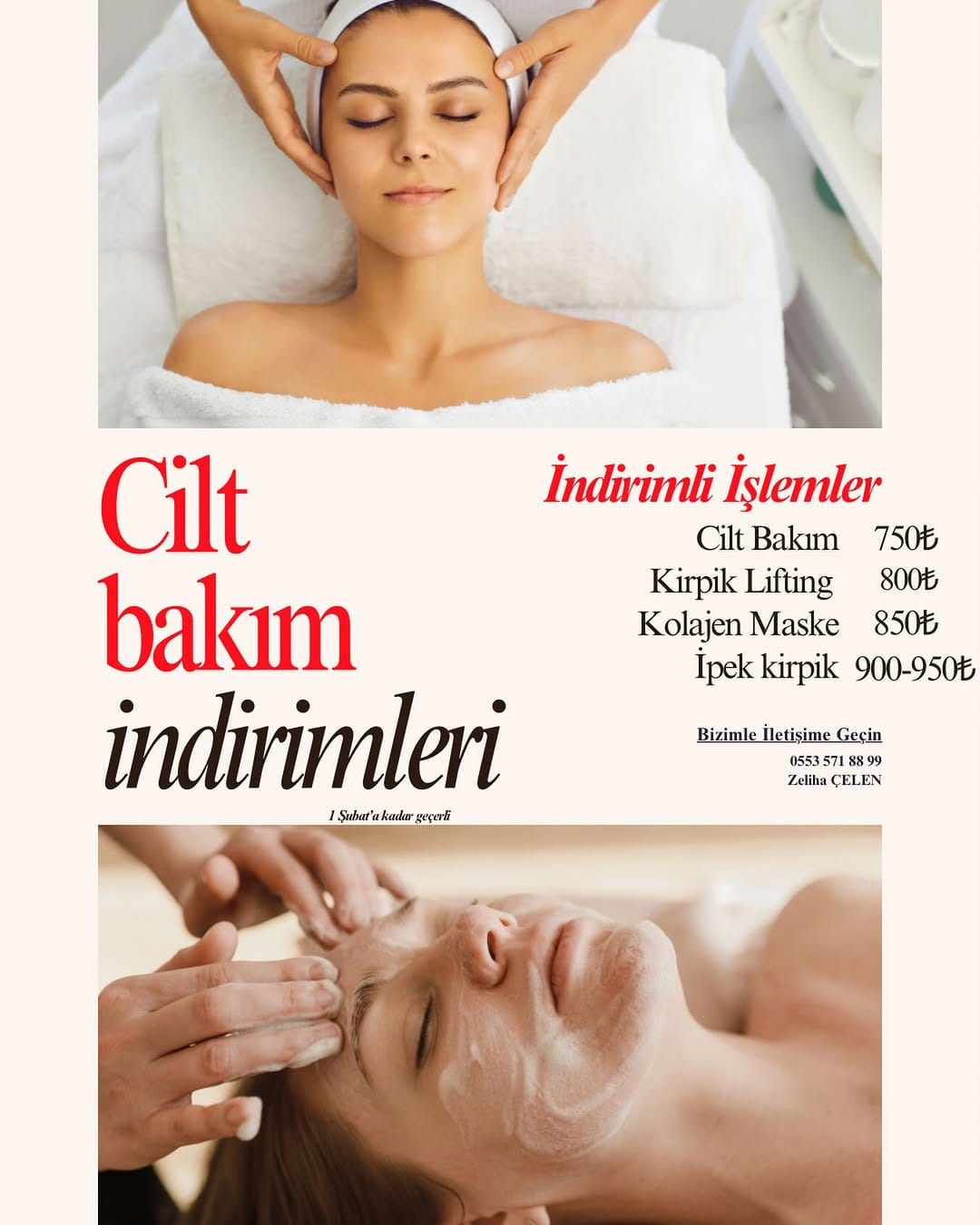 Post 2 by Protez Tırnak Ankara on Instagram (image)