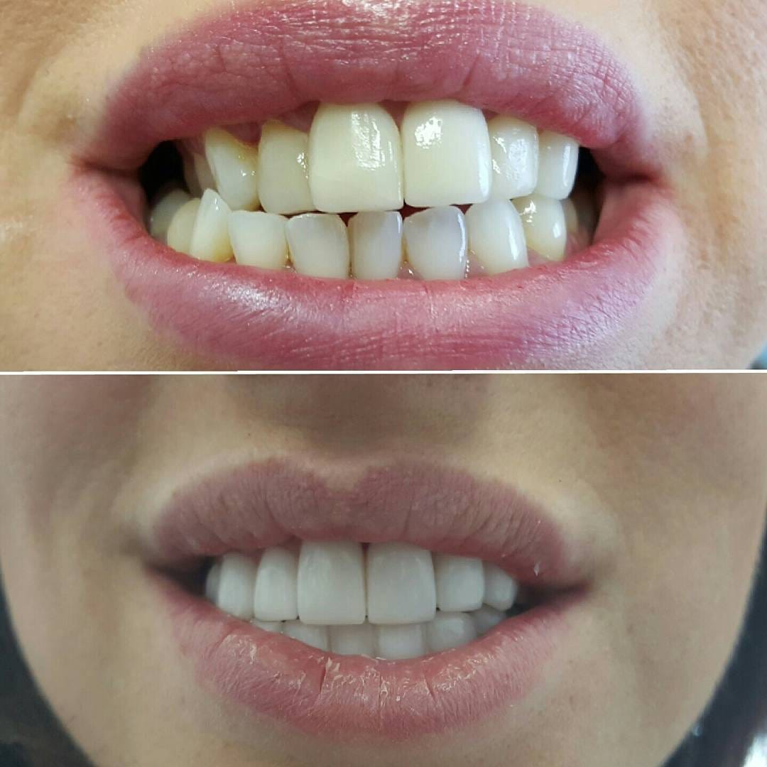 Post 2 by Classic Dental Clinic on Instagram (image)