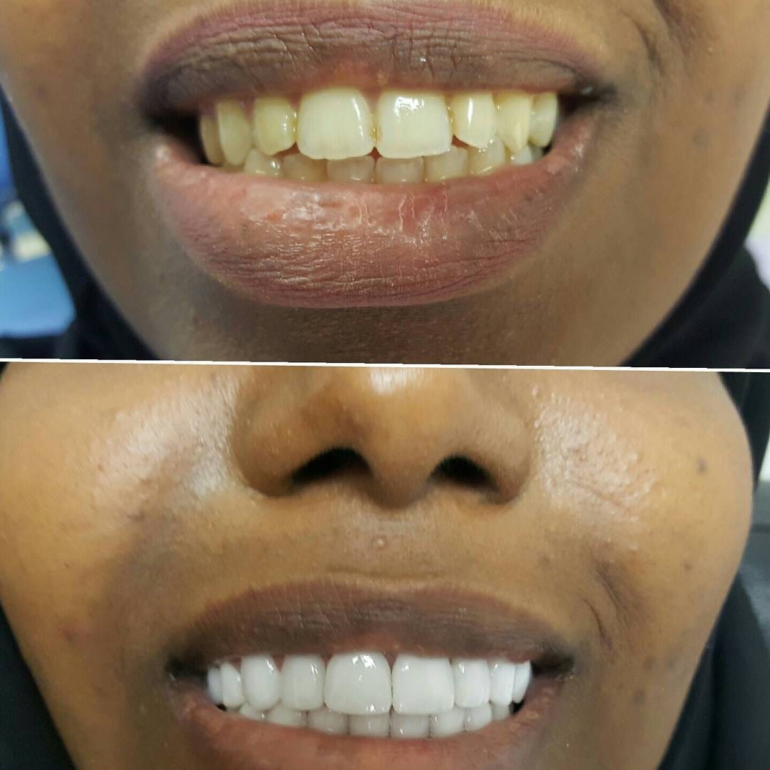 Post 4 by Classic Dental Clinic on Instagram (image)