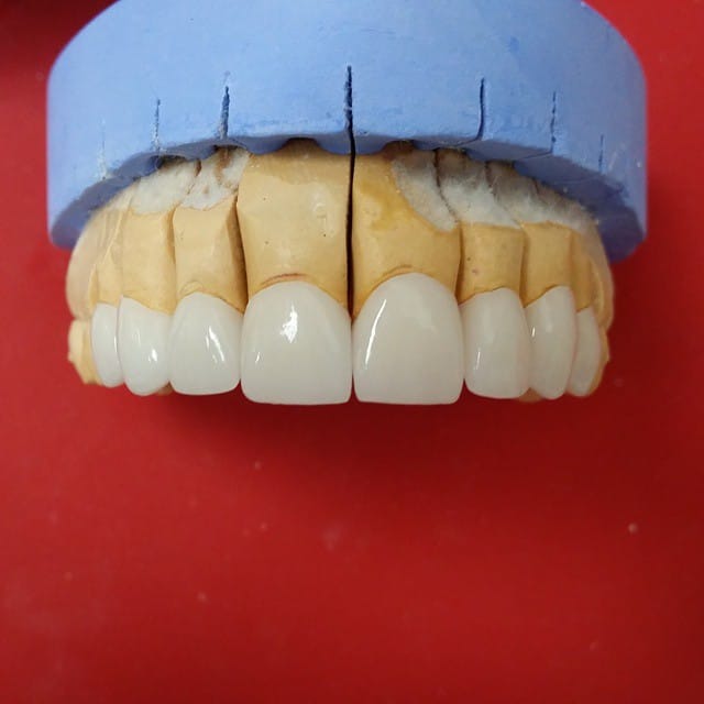 Post 10 by Classic Dental Clinic on Instagram (image)
