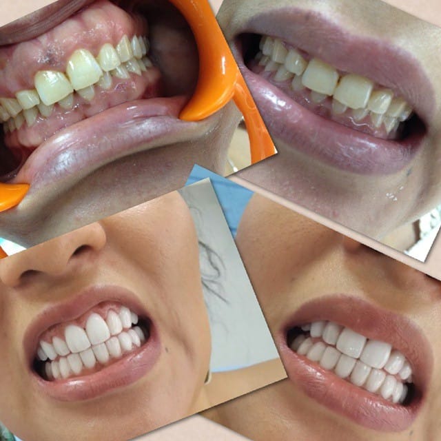 Post 9 by Classic Dental Clinic on Instagram (image)