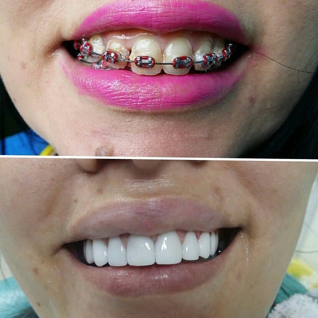 Post 8 by Classic Dental Clinic on Instagram (image)