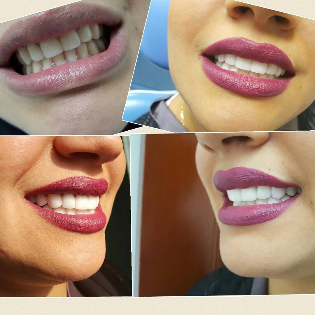 Post 6 by Classic Dental Clinic on Instagram (image)