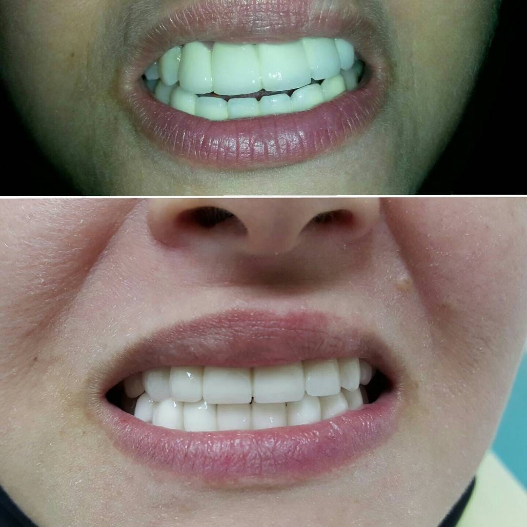 Post 3 by Classic Dental Clinic on Instagram (image)