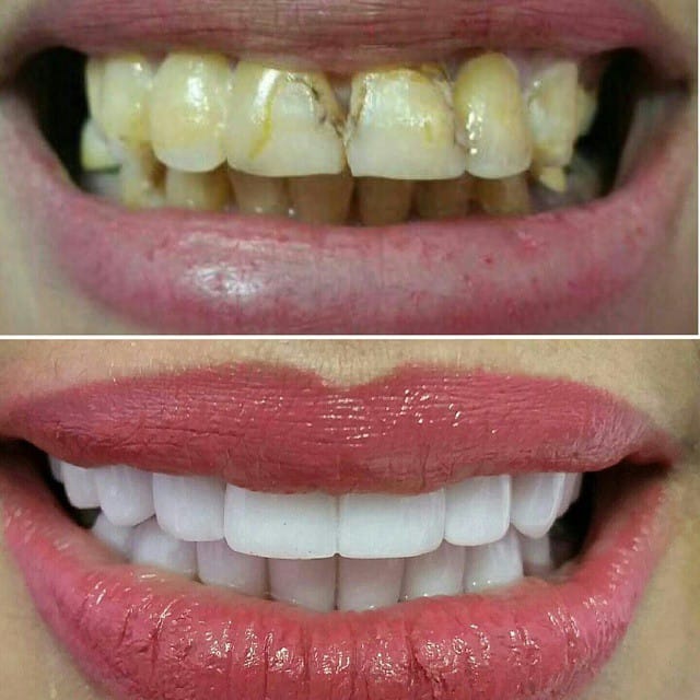 Post 7 by Classic Dental Clinic on Instagram (image)