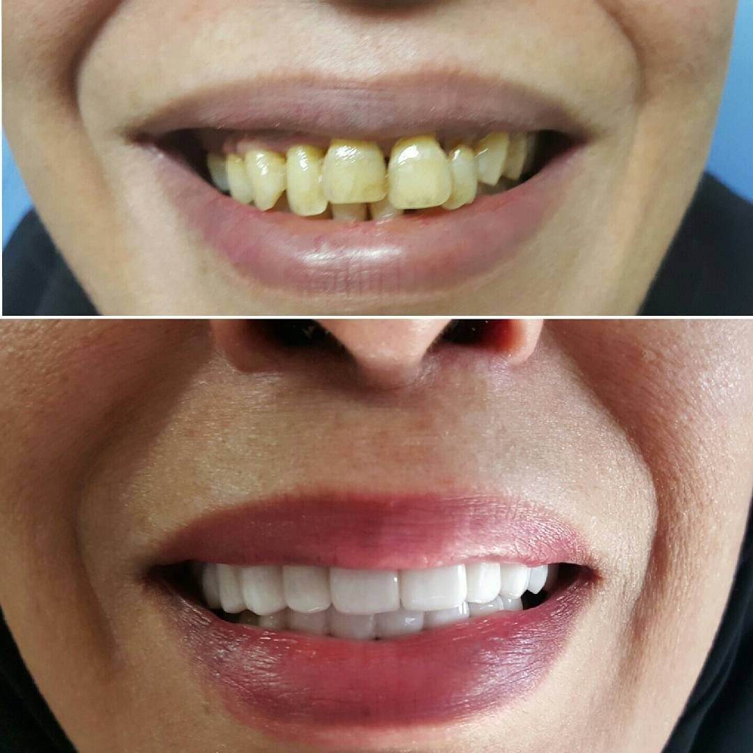 Post 5 by Classic Dental Clinic on Instagram (image)
