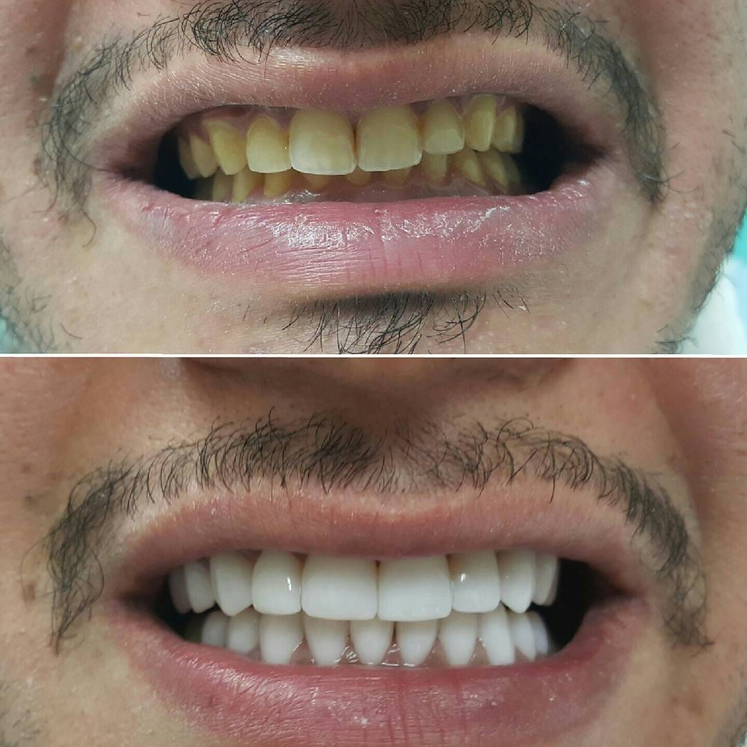 Post 1 by Classic Dental Clinic on Instagram (image)