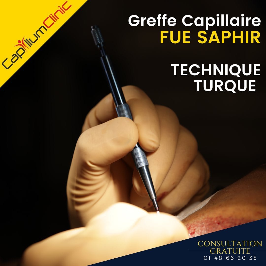 Post 2 by Capillum Clinic on Instagram (image)