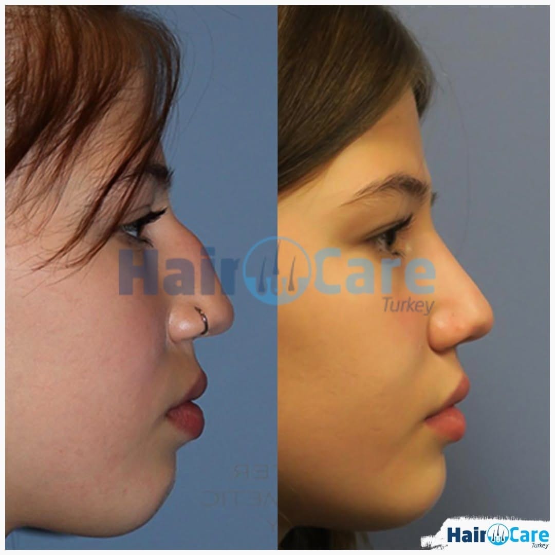 Post 5 by Hair Care Turkey on Instagram (image)