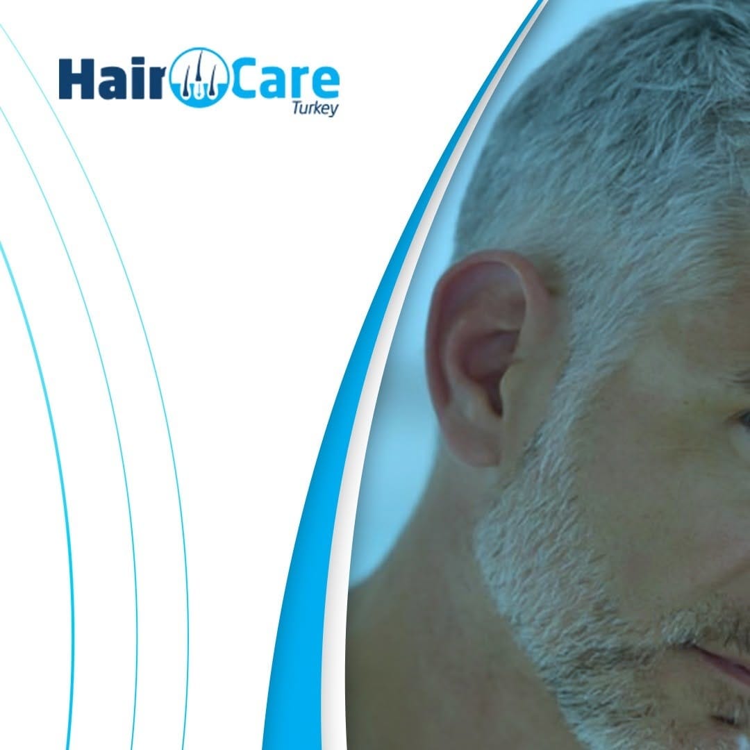 Post 1 by Hair Care Turkey on Instagram (image)