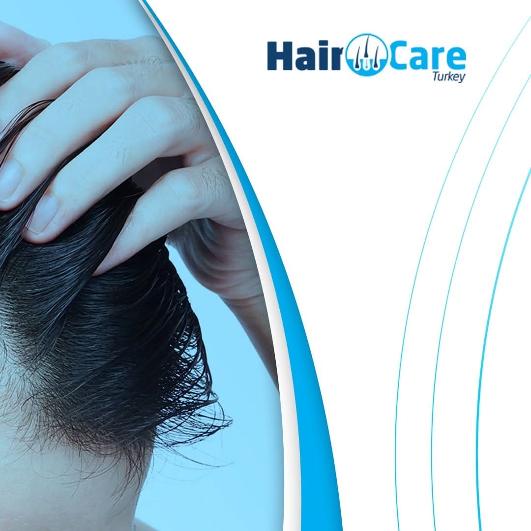 Post 9 by Hair Care Turkey on Instagram (image)