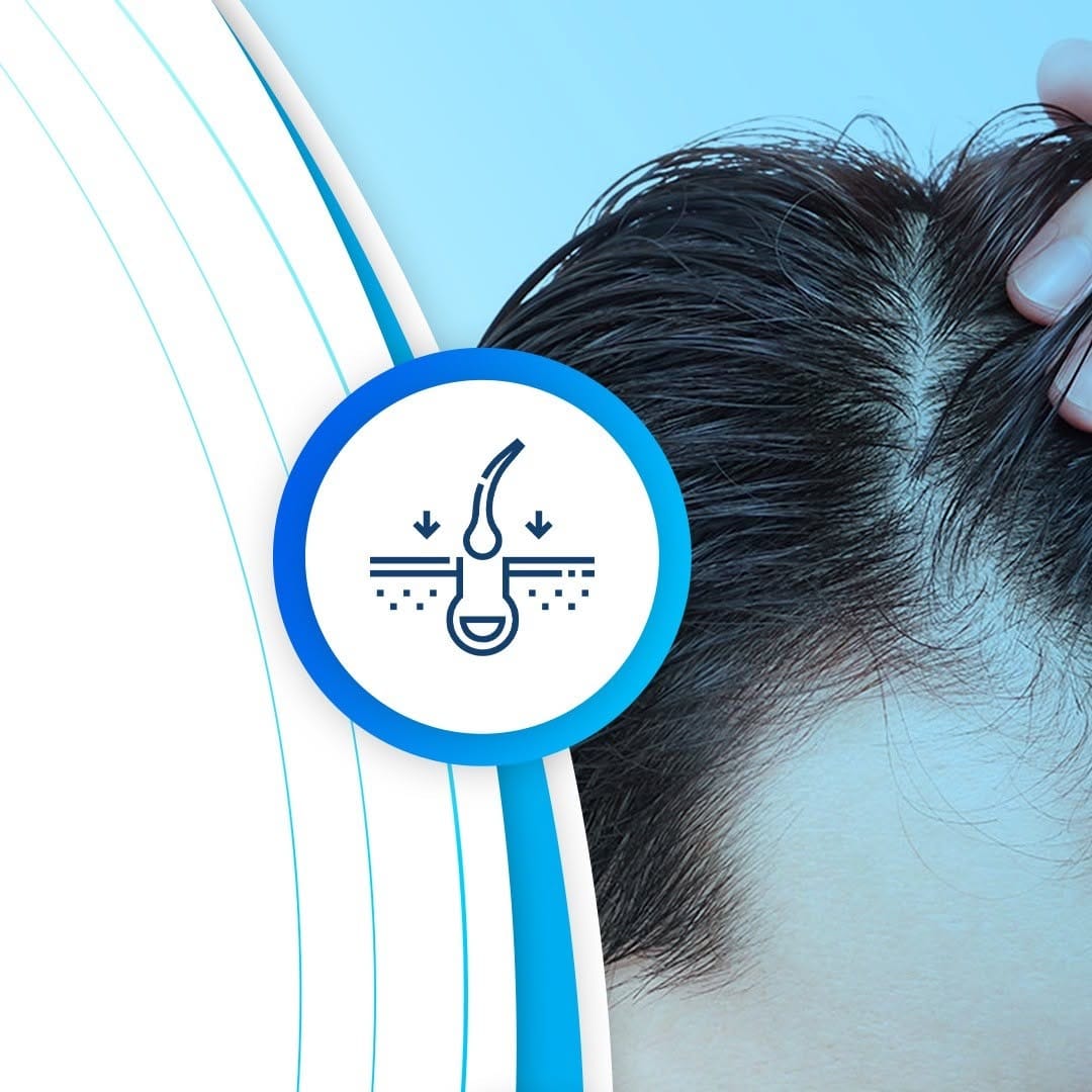 Post 8 by Hair Care Turkey on Instagram (image)
