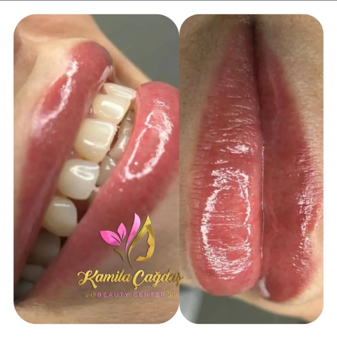 Post 10 by KAMILAÇAGDAŞBEAUTY on Instagram (image)