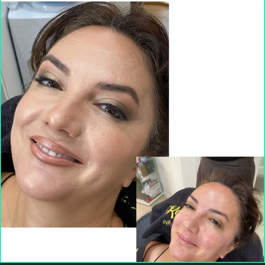 Post 3 by KAMILAÇAGDAŞBEAUTY on Instagram (image)