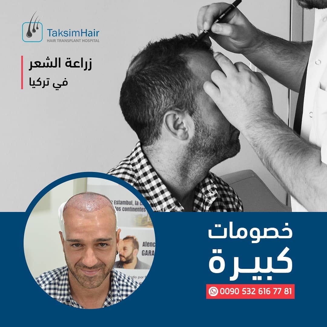 Post 1 by TaksimHair on Instagram (image)