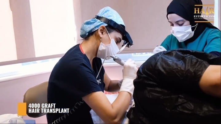 Post 4 by Hair Estheticism Hair Transplant on Instagram (video)