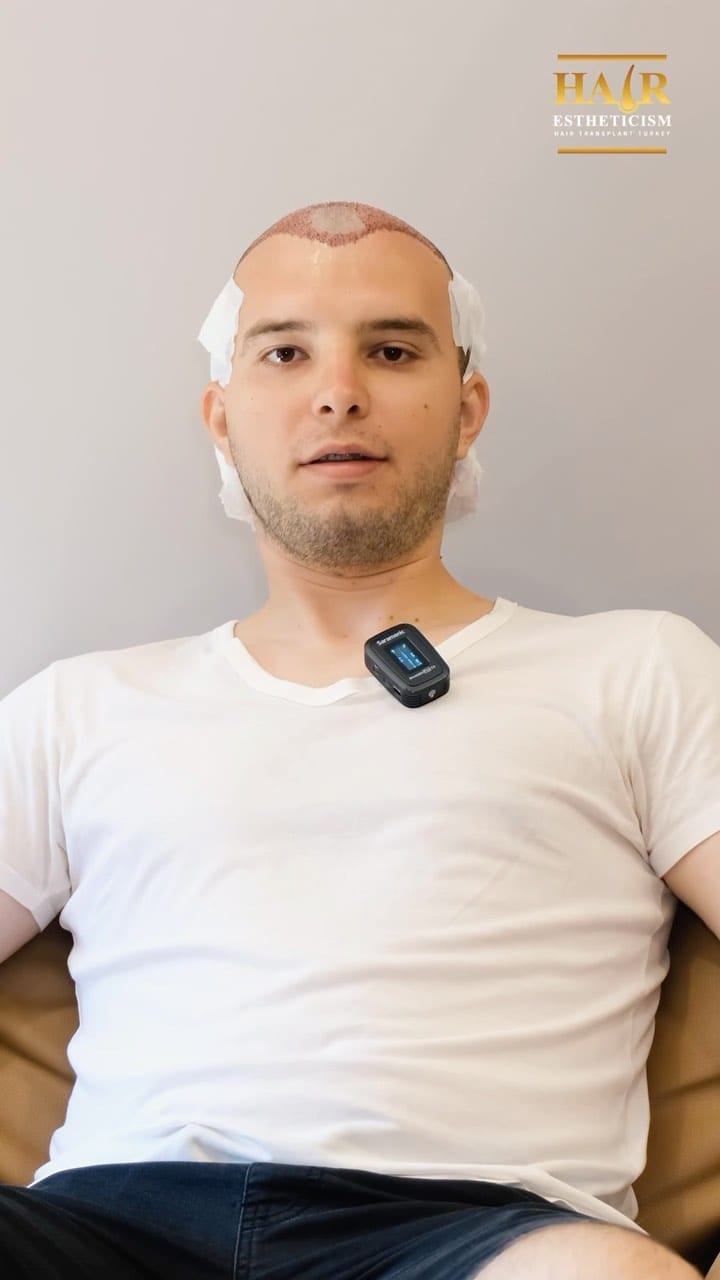 Post 3 by Hair Estheticism Hair Transplant on Instagram (video)