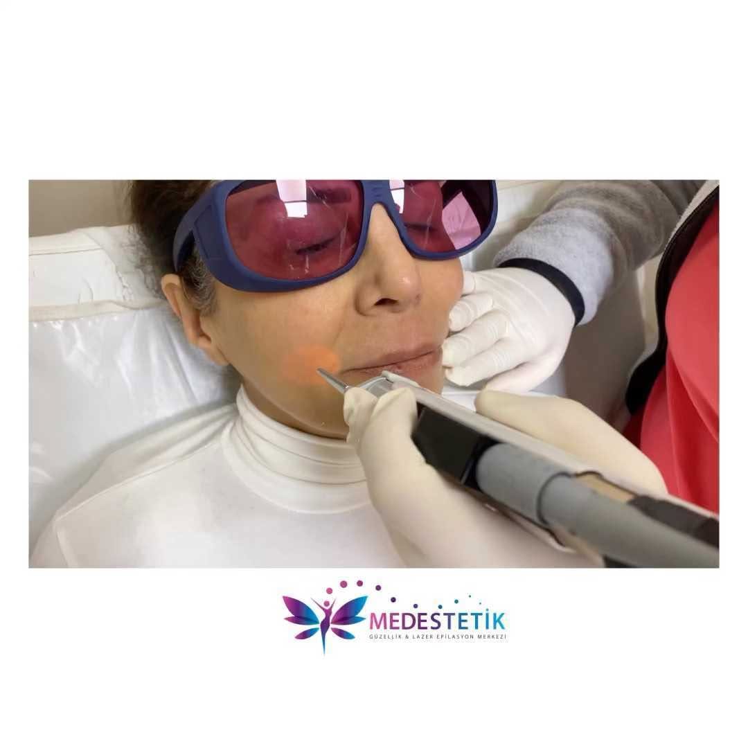 Post 9 by MED SAĞLIK🆃🆁 on Instagram (video)