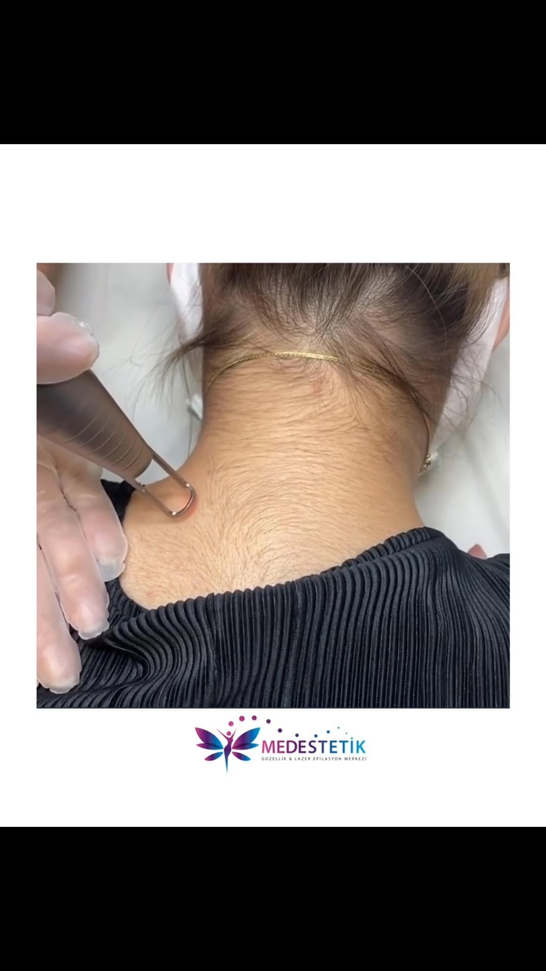 Post 10 by MED SAĞLIK🆃🆁 on Instagram (video)